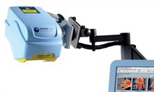 Laser Doppler Imaging - courtesy of Moor Instruments
