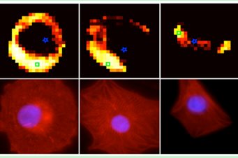 Raman spectroscopy vs Fluorescence